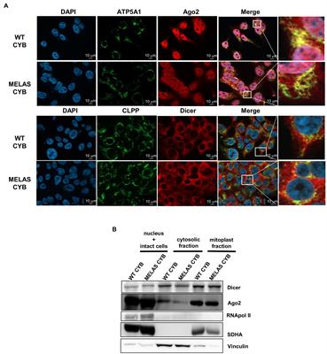 mt tRFs, New Players in MELAS Disease